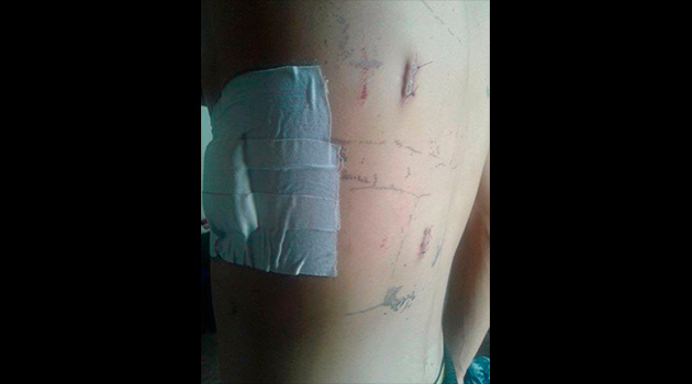 Artista-herido-bello2